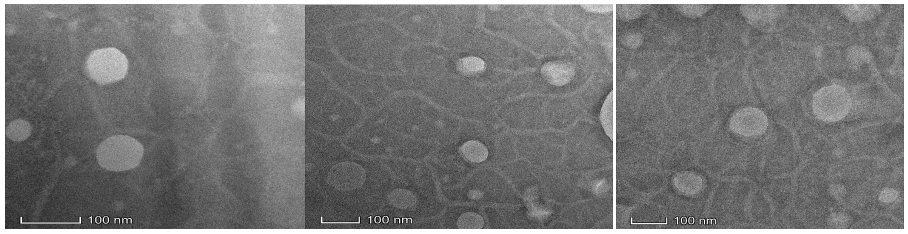 TK+targeted peptide LTHVVWL modified liposomes simultaneously loaded with siRNA+methylprednisolone