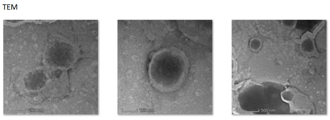 LipoCP loaded curcumin and PDA,100nm-200nm 