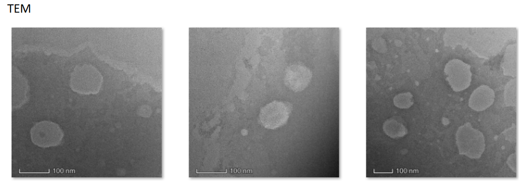 LipoC loaded curcumin,100nm-200nm