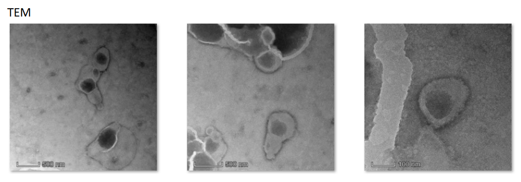 LiPOP loaded PDA(polydopamine)