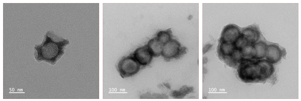 RGD modified macrophage membrane encapsulating hollow manganese dioxide@L-Arg