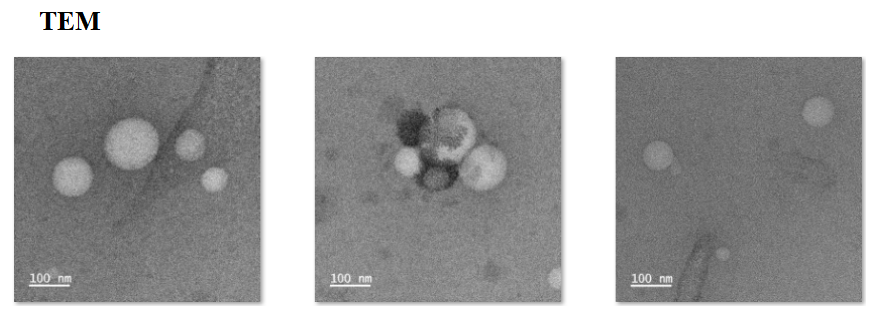 CY5.5 modified liposomes@Celastrol surface modified RGD 