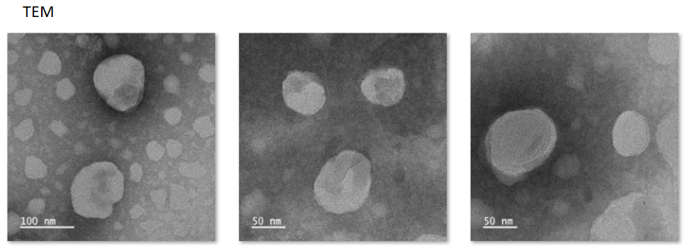 Liposomal nanoparticles@Notoginsenoside Ft1+CY5.5 surface modified FSH targeting peptide