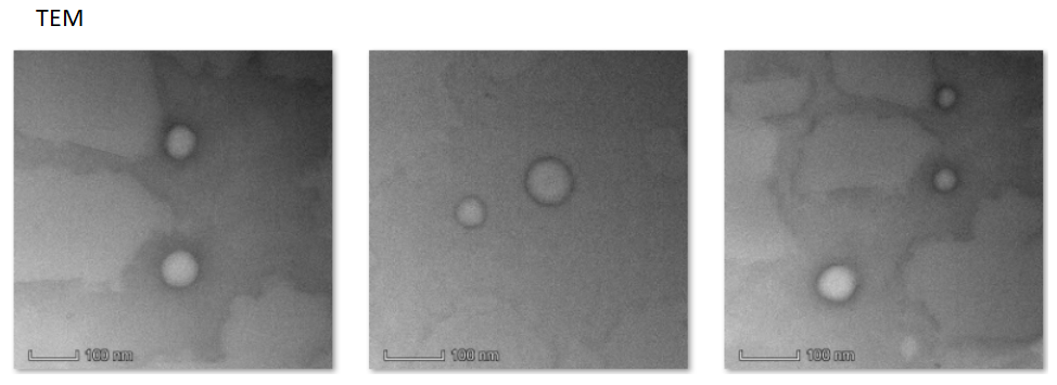 Liposomal nanoparticles@Ginkgolide B and fluorescent CY5.5 surface modified FSH targeting peptide 