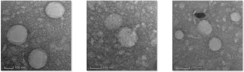 Liposomal@Erianin and CY5-TPP (Triphenylphosphine),±100nm